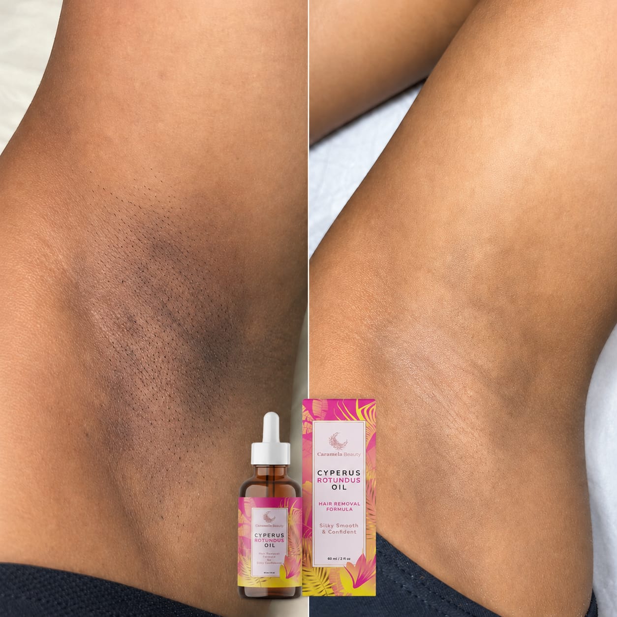 Underarm skin before and after