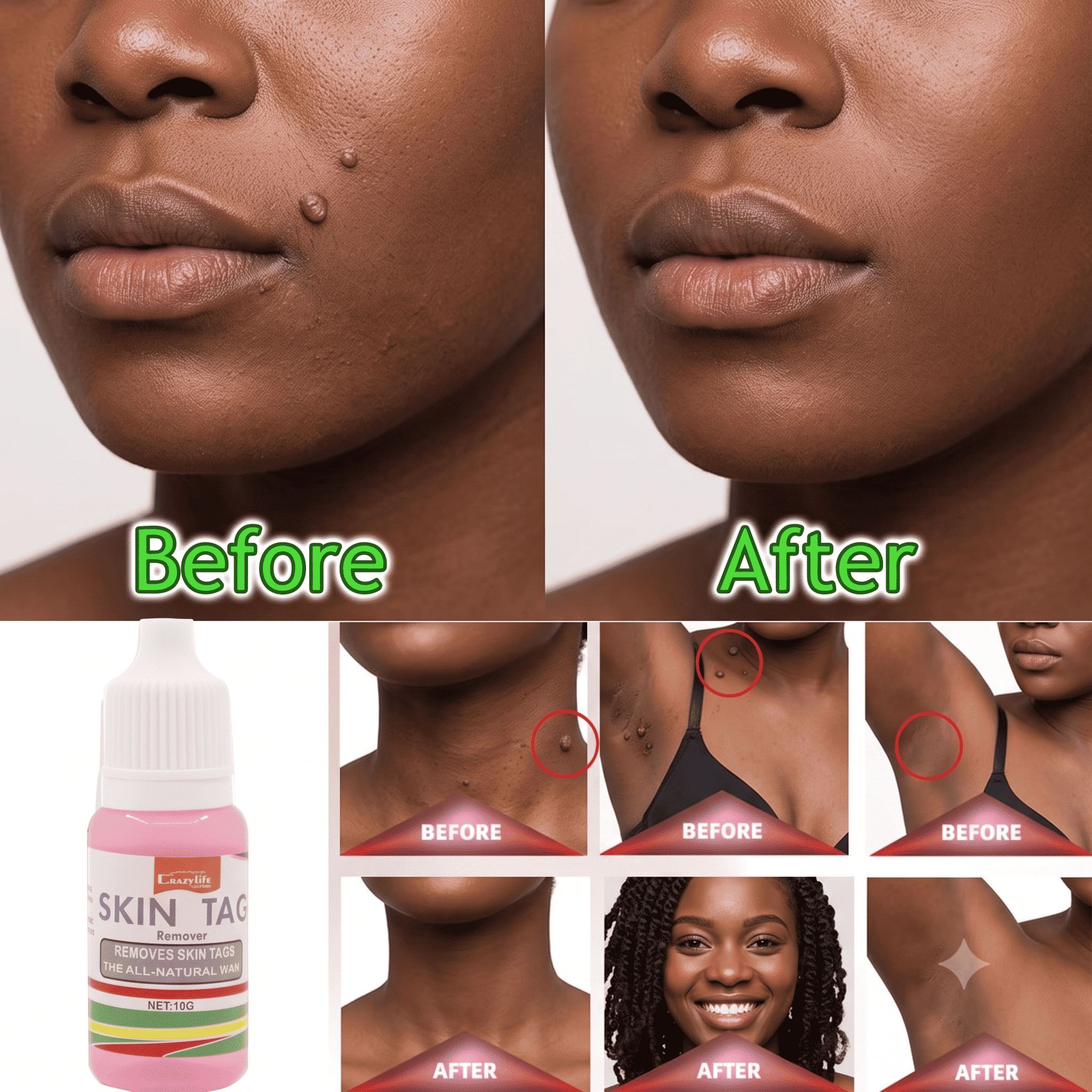 Before and after result