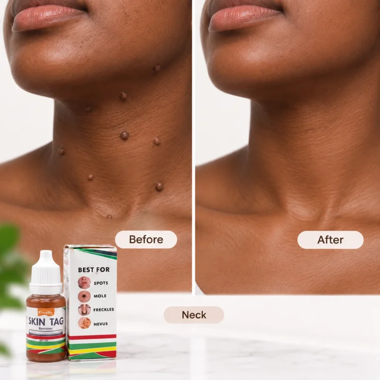 Before and after result
